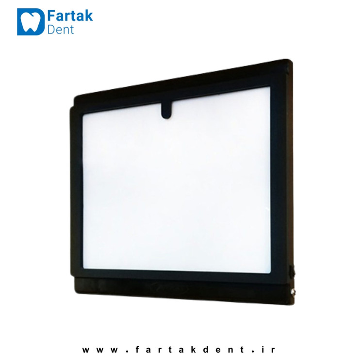 نگاتسکوپ LED دیجیتال عاج طب