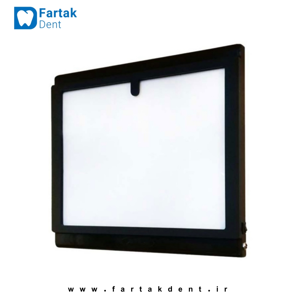 نگاتسکوپ دیجیتال