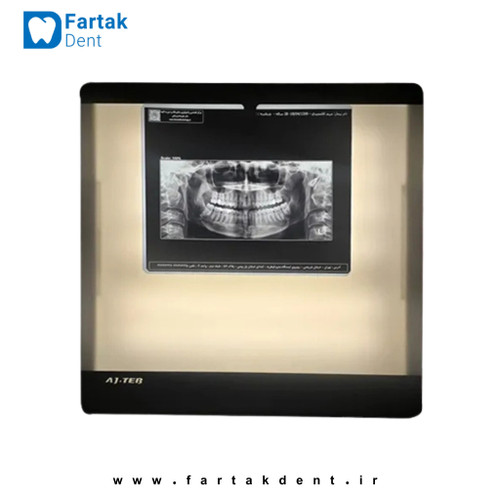 نگاتسکوپ دیجیتال عاج طب