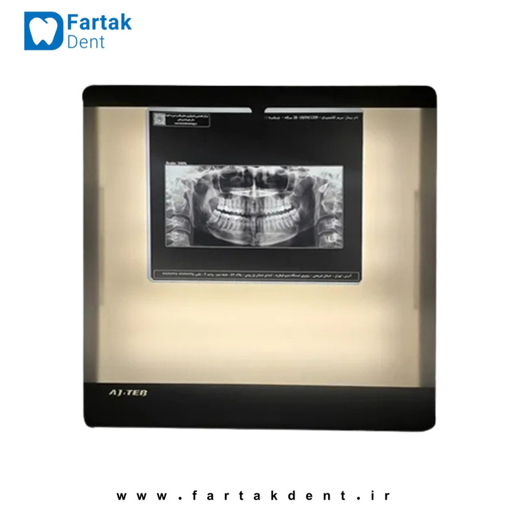 نگاتسکوپ دیجیتال عاج طب